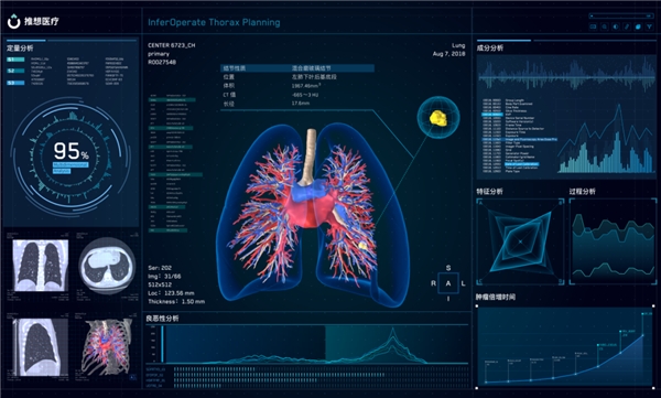 _src=https://aliypic.oss-cn-hangzhou.aliyuncs.com/Uploadfiles/20220926/2022092614482479.004.png