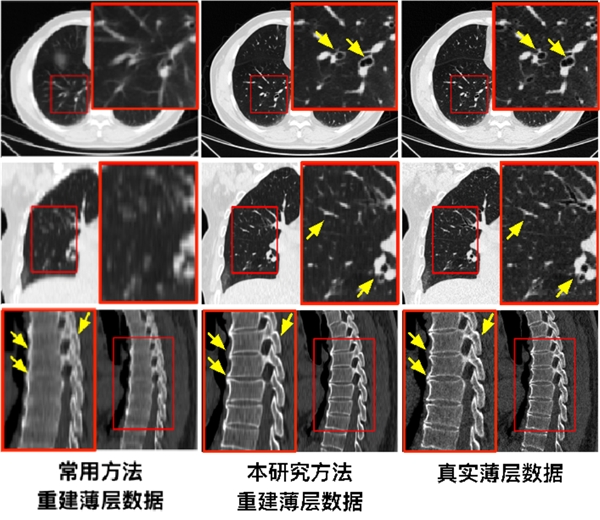 _src=https://aliypic.oss-cn-hangzhou.aliyuncs.com/Uploadfiles/20220926/2022092614482479.005.png